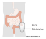 LIVE IN-PERSON 12 CE Swedish Oncology & Bodywork for Cancer