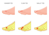 12 CE Hour Foot Reflexology Basics with Advanced Medical Foot Massage (Computer-Based Live Interactive Webinar)