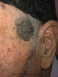 Self-paced Online Home Study 12 CE Oncology & Geriatric Massage