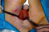 Self-paced Online Homestudy 1 CE Lymphatic Drainage: Tissues & Theory