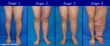 LIVE IN-PERSON 18 CE Hour Full Body Manual Lymphatic Drainage