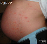 Self-paced Online Home Study 6 CE Prenatal Terms, Contraindications & Side Lying Massage